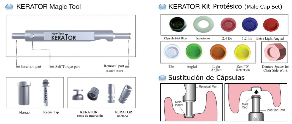 Componentes principales del Sistema Kerator
